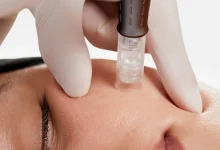 Pro Microneedling