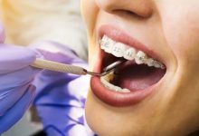 Understanding Modern Dental Treatments: Innovations and Advancements in Oral Health